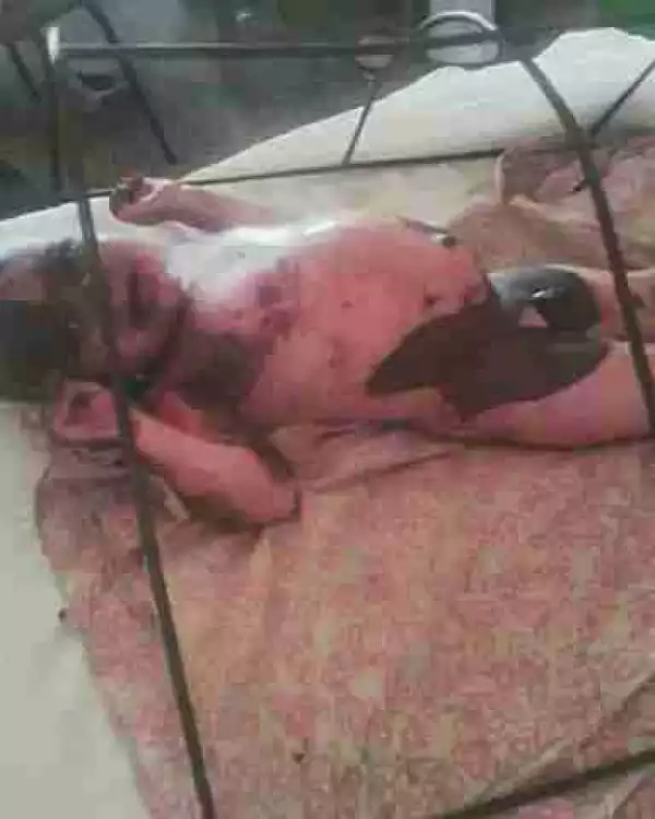 Hot Water Poured On Baby By His Jealous Stepmother In Katsina (Graphic Photo)